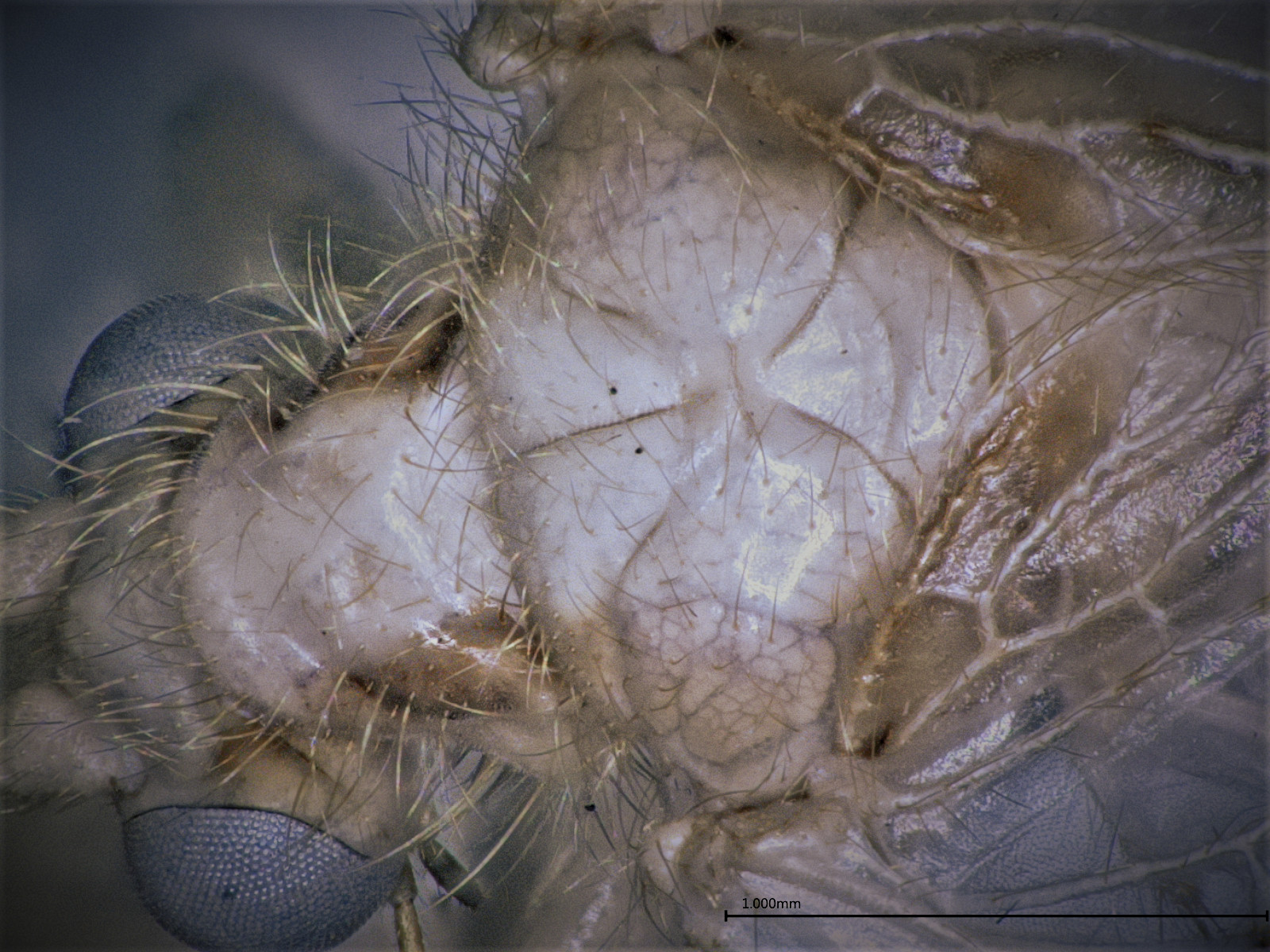 Hemerobius-costalis-dorsum-mesothoracic-dorsal-ventral-musculature-visible